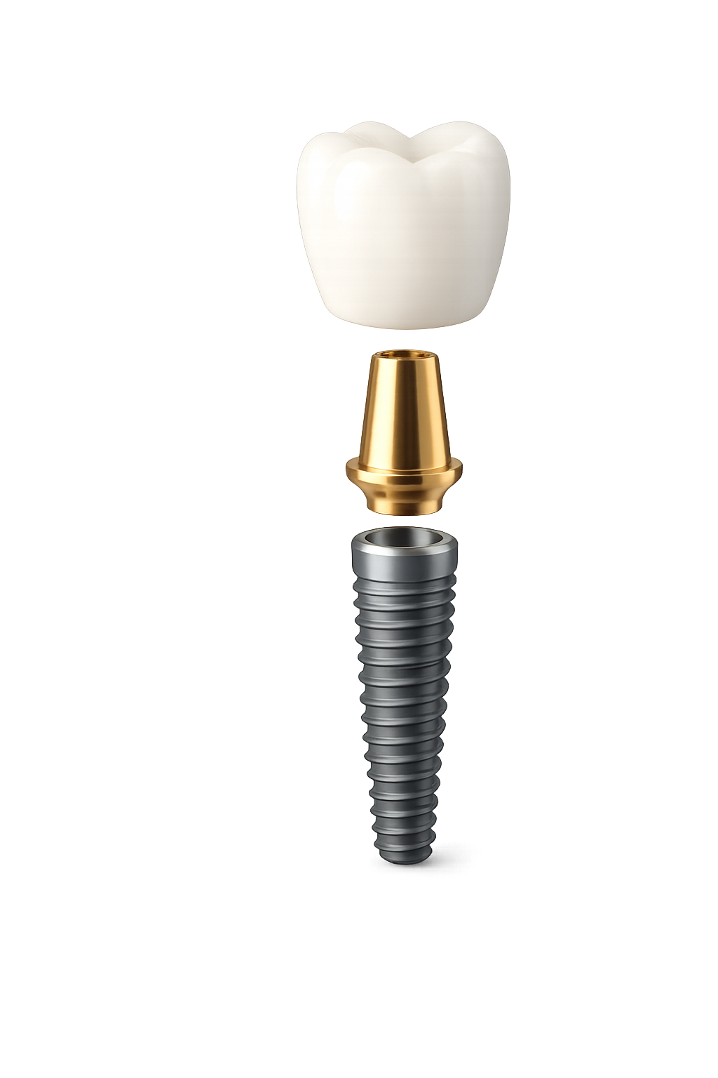 Dental implant structure — ceramic crown, abutment and titanium implant